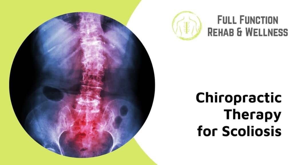 chiro for scoliosis woodbridge